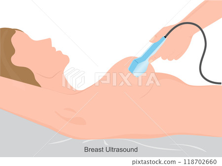 Breast ultrasound is an imaging test that uses sound waves. 118702660