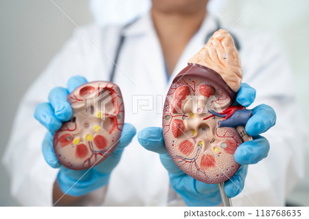 Chronic kidney disease, doctor with model for treatment urinary system, urology, Estimated glomerular filtration rate eGFR. Chronic kidney disease, doctor with model for treatment urinary system, urology, Estimated glomerular filtration rate eGFR. 118768635