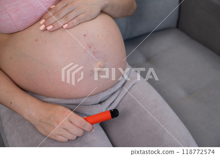 A pregnant woman smokes a vape while sitting on the couch. Close-up of the belly with allergies. 118772574