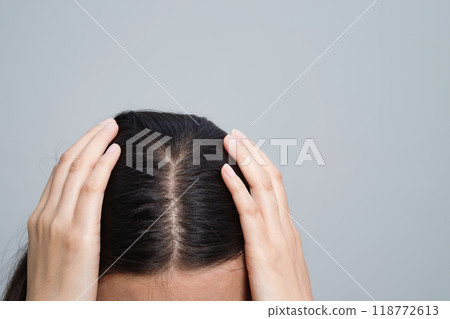 A woman has a problem with hair loss. A woman has a problem with hair loss. 118772613