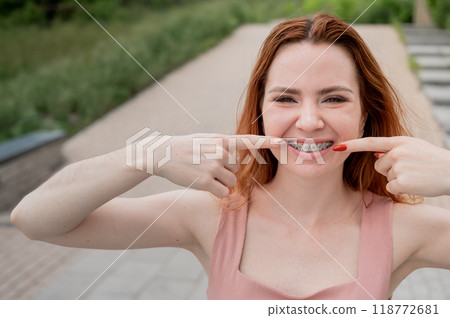 Young red-haired woman with braces on her teeth point to a smile outdoors in summer 118772681