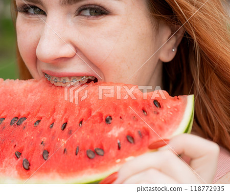 Close-up portrait of red-haired young woman with braces eating watermelon outdoors Close-up portrait of red-haired young woman with braces eating watermelon outdoors 118772935