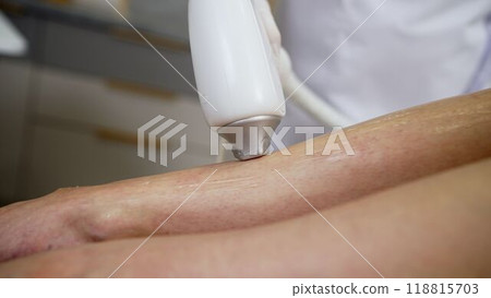 Body cream or anti-cellulite scrub, smear of gel on female leg. A professional cosmetologist applies gel to a client's leg before a laser hair removal procedure in a salon, close-up. Body cream or anti-cellulite scrub, smear of gel on female leg. A professional cosmetologist applies gel to a client's leg before a laser hair removal procedure in a salon, close-up. 118815703