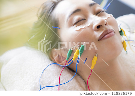 使用針灸電極低頻治療儀進行美容針灸的年輕女性 118826179