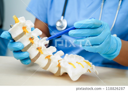 Asian doctor holding spinal nerve and bone model, Lumbar spine displaced herniated disc fragment for treatment medical in the orthopedic department. 118826287