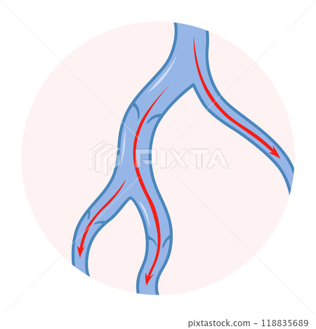 Varicose veins. Blue blood vessel visible through the skin. Vascular disease diagnostic and treatment. Venous insufficiency medical 118835689