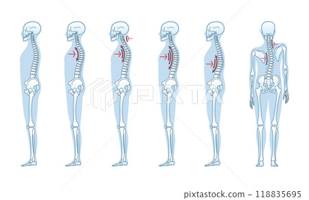Understanding the Different Types of Standing Posture for Achieving Better Health and Wellness 118835695