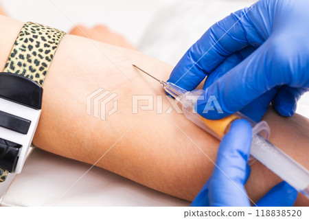 Nurse taking a blood sample from a patients arm Nurse taking a blood sample from a patients arm 118838520
