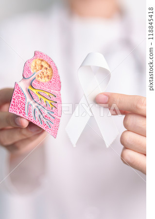 November Lung Cancer Awareness month. Doctor with Smoker Lung anatomy model and White ribbon in hospital. Healthcare and World Cancer day concept November Lung Cancer Awareness month. Doctor with Smoker Lung anatomy model and White ribbon in hospital. Healthcare and World Cancer day concept 118845418