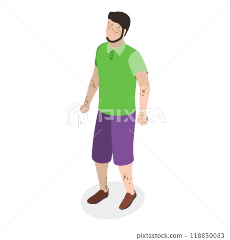 3D Isometric Flat  Set of Happy People with Vitiligo. Item 2 118850083