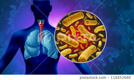 Whooping Cough 118852660