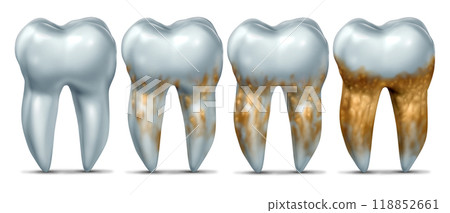 Tooth Disease Growth 118852661
