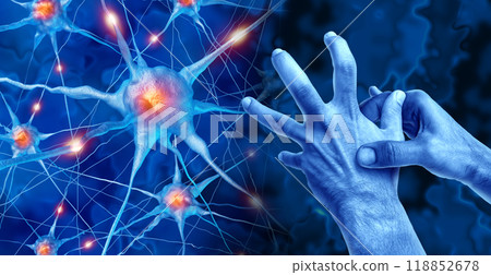 Parkinson's Disease 118852678