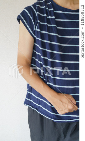 Sunburn on arm (male) Sunburn on arm (male) 118859512