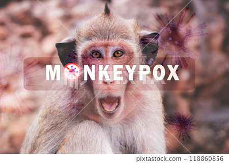 Mpox caused by monkeypox virus. Monkeypox outbreak. Viral transmission from animals to humans. Smallpox vaccine, and public health efforts in controlling spread of disease. Virus harbored in monkeys. 118860856