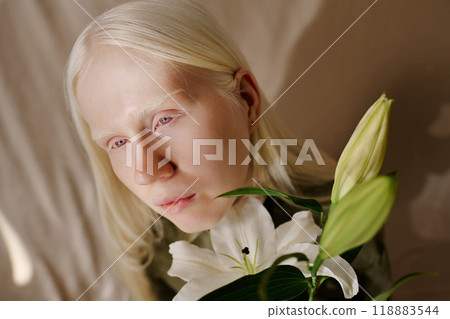 High angle view medium closeup of young woman with albinism posing for portrait with beautiful white lilium flowers 118883544