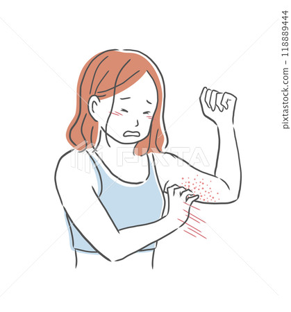 Illustration of a woman scratching a pimple on her upper arm Illustration of a woman scratching a pimple on her upper arm 118889444