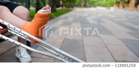 Prominently featured orange-casted leg in the foreground, with the tranquil scenery of a summer park providing the out-of-focus background, copy space 118891250