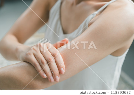 一位女士在上臂塗抹潤膚霜 118893682