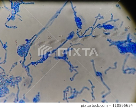 顯示孢子囊大小的顯微鏡照片 118896654