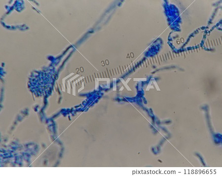 孢子囊破裂、內容物暴露的黴菌 118896655