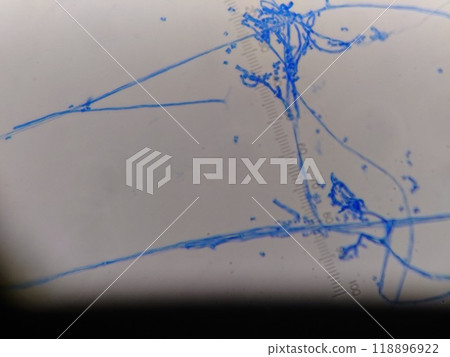 具有細菌絲的黴菌 118896922