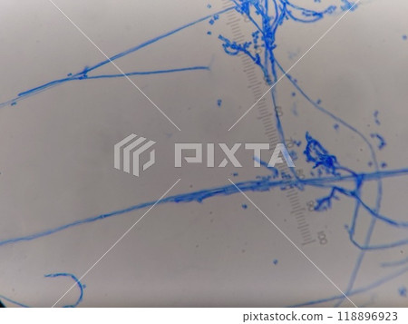 測量薄黴菌菌絲的厚度 118896923
