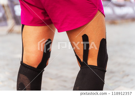 Athletic Tape Binding on the knees and legs with stockings on the girl's runner Marathoner Athletic Tape Binding on the knees and legs with stockings on the girl's runner Marathoner 118912357