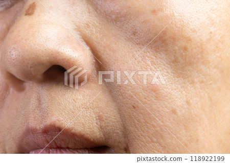 Flabby and wrinkled skin on senior woman face. 118922199