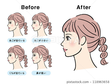 Female profile set E-line before and after 118963658
