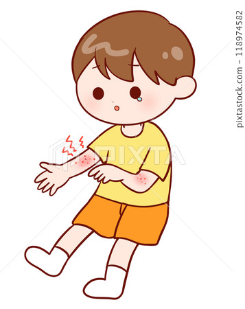 A boy with an itchy rash on his arm A boy with an itchy rash on his arm 118974582