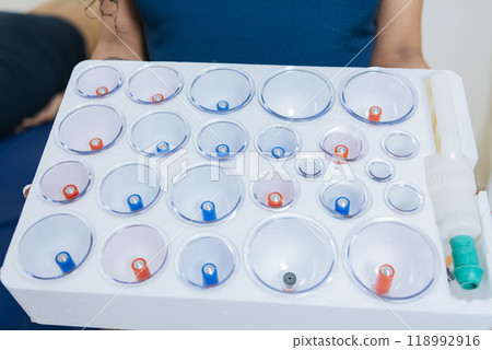 Cupping kit for physiotherapy. Physiotherapist hands holding cupping cups, Hands holding cupping box for physiotherapy 118992916