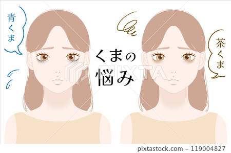 Illustration of a woman suffering from dark circles 119004827