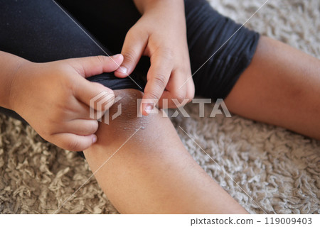 Close up on little girl suffering knee joint pain.. 119009403