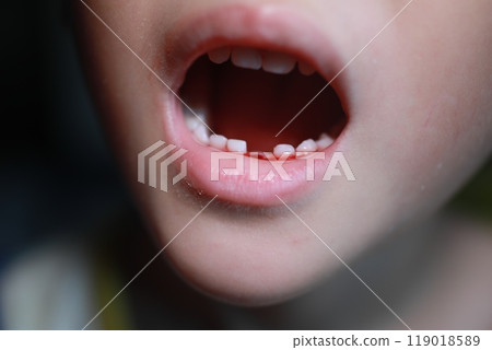 Change teeth 119018589