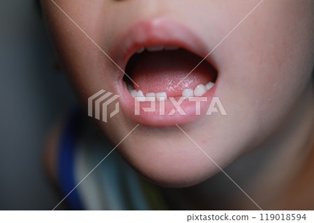 Change teeth 119018594