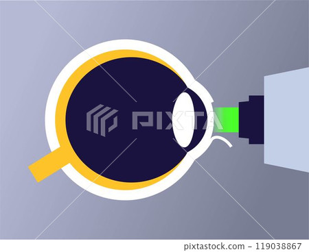 Lasik eye surgery 119038867