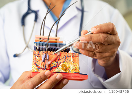 Asian dermatologist doctor holding skin structure model anatomy for treatment in hospital, hair transplant. 119048766
