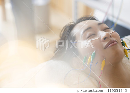 A young woman undergoing cosmetic acupuncture using an acupuncture electrode low-frequency treatment device 119051543