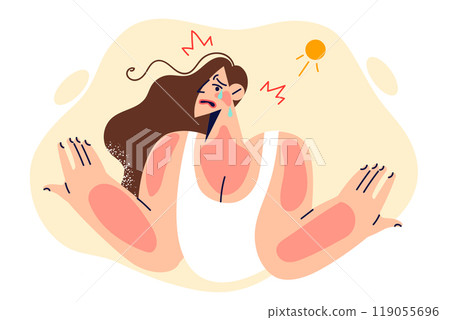 Unfortunate woman received sunburns on face and body due to being under blazing sun for long time 119055696