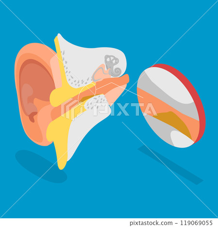 3D Isometric Flat Vector Illustration of Earwax Blockage, Blocked Ear Canal Due To Excess Ear Wax Buildup 3D Isometric Flat Vector Illustration of Earwax Blockage, Blocked Ear Canal Due To Excess Ear Wax Buildup 119069055