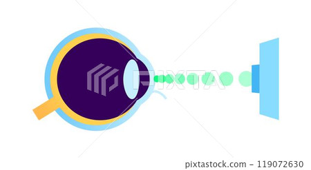 Lasik eye surgery Lasik eye surgery 119072630