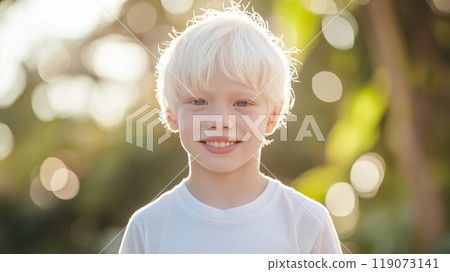 Smiling Young Albino Thai Boy Outdoors in Natural Light Suitable for Inspirational and Educational Content Smiling Young Albino Thai Boy Outdoors in Natural Light Suitable for Inspirational and Educational Content 119073141