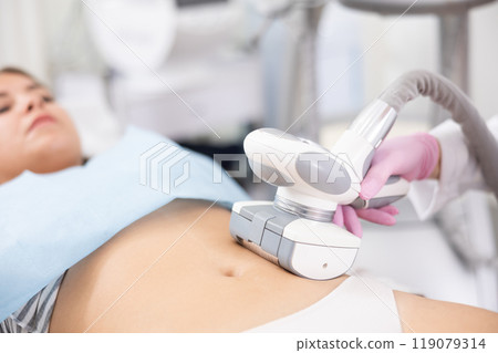 LPG massage device applied on young woman's belly 119079314