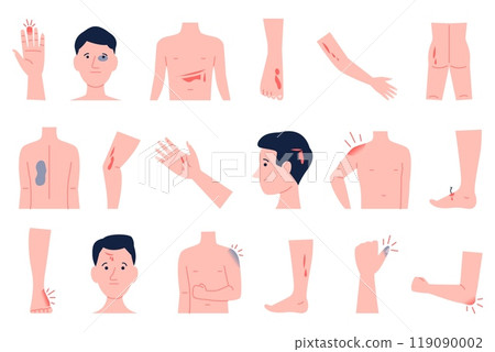 Physical injury. Human body parts with various wounds injury bruise. Physical traumas on head hand legs or face, bones fractures and cut, recent vector set Physical injury. Human body parts with various wounds injury bruise. Physical traumas on head hand legs or face, bones fractures and cut, recent vector set 119090002