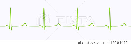 ECG of type 3 long QT syndrome, 3D illustration ECG of type 3 long QT syndrome, 3D illustration 119101411
