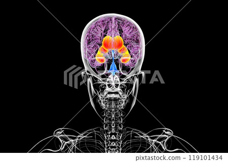 Enlarged lateral ventricles of the brain, 3D illustration Enlarged lateral ventricles of the brain, 3D illustration 119101434
