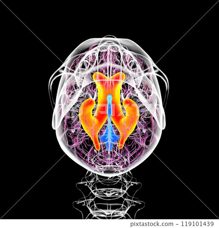 Enlarged lateral ventricles of the brain, 3D illustration Enlarged lateral ventricles of the brain, 3D illustration 119101439