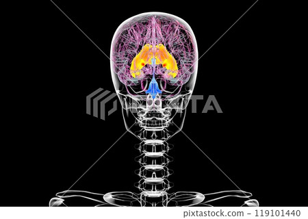 Enlarged lateral ventricles of the brain, 3D illustration Enlarged lateral ventricles of the brain, 3D illustration 119101440
