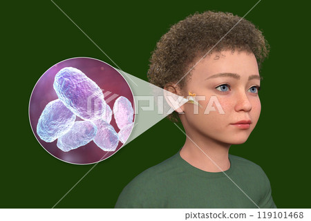 Otitis media in a child, 3D illustration 119101468